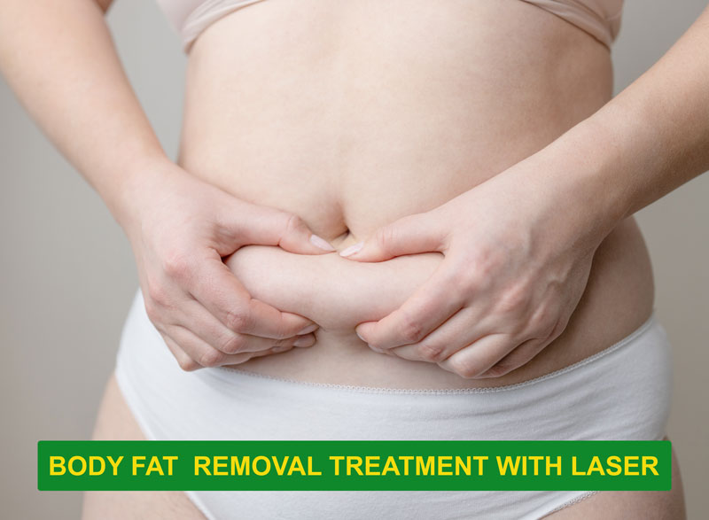 Fat removal treatment with laser in Gurgaon is executed to remove extra body fat to give you a contoured look