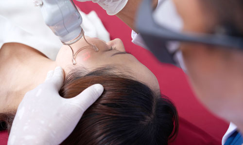 Diode Laser Hair Removal treatment in Gurgaon is ideal for medium and coarse hair removal treatment permanently