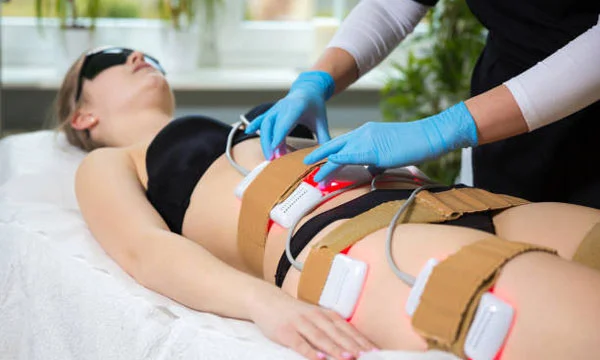 Laser-Lipo is a laser fat removal treatment in Gurgaon which is non-invasive and use of laser technology to reduce fat